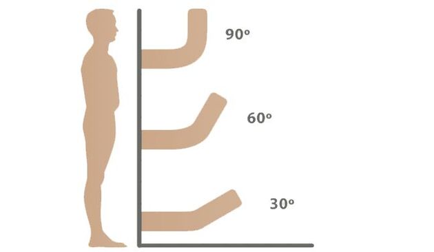 Techniques for penis straightening